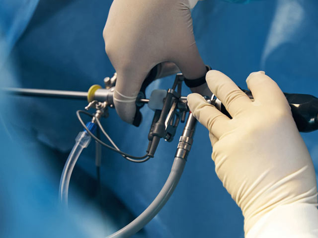 All inclusive Gastric Sleeve