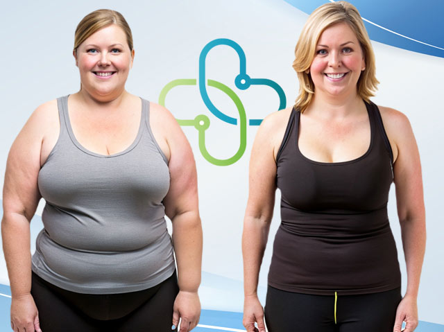 Before-and-After-Woman-2
