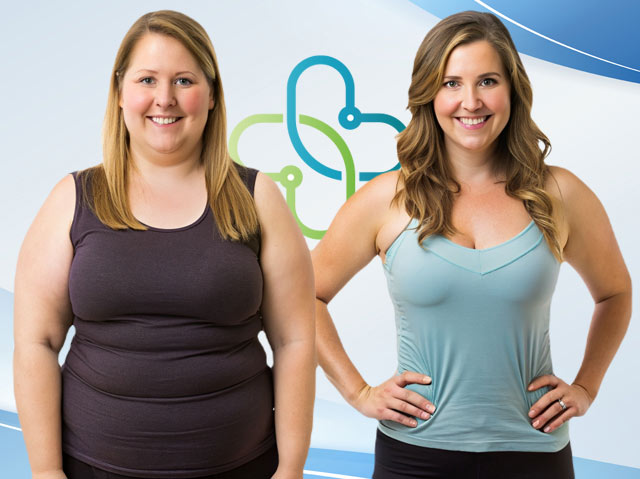 Before-and-After-Woman-3